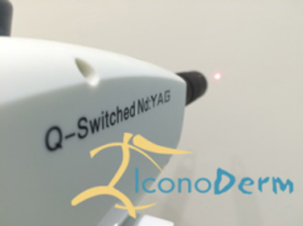 IconoDerm: Última tecnología en borrado de tatuajes