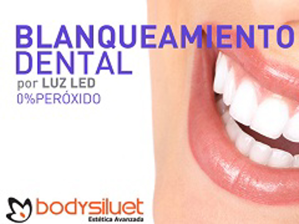 Franquicias Bodysiluet, pioneras en blanqueamiento dental